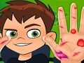 Гульня BEN10 HAND DOCTOR онлайн