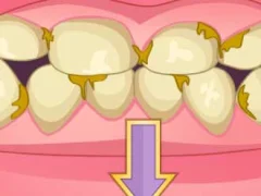 Гульня Bad Teeth Makeover онлайн