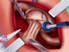 Гульня Princess Hips Surgery онлайн
