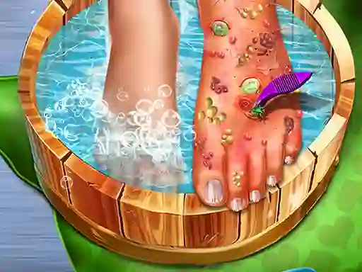 Гульня Feet Skin Doctor онлайн