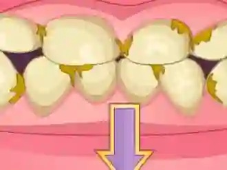 Гульня Bad Teeth Makeover онлайн