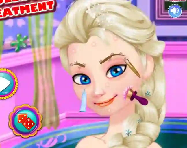 Гульня Ice Queen Acne Treatment онлайн