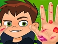 Гульня BEN10 HAND DOCTOR онлайн